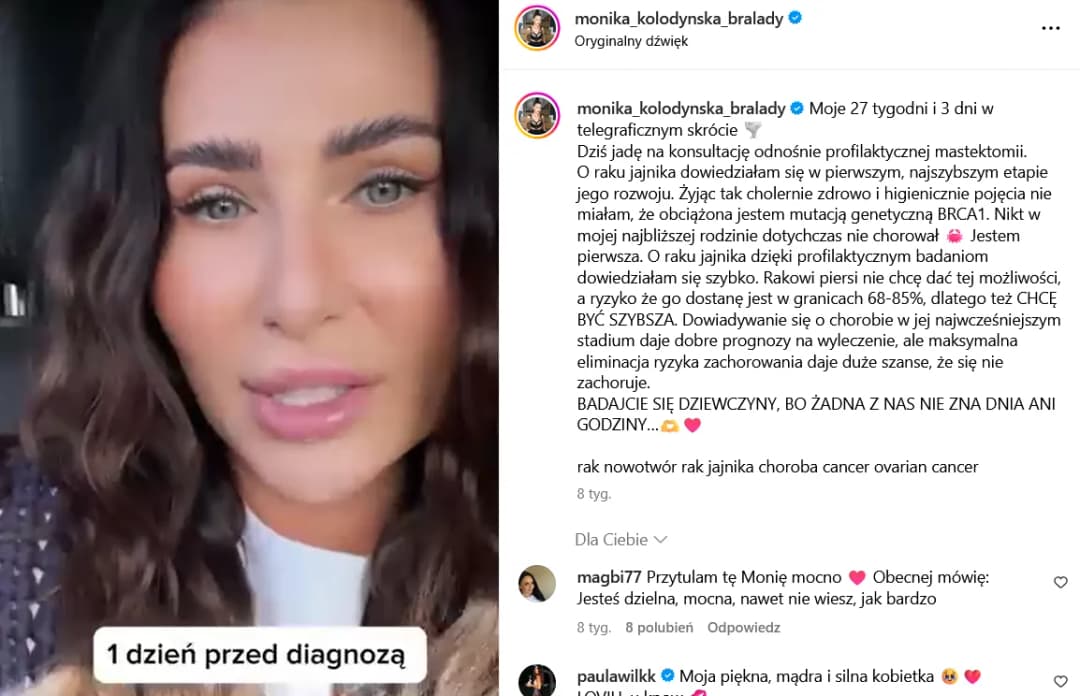 Wczesne objawy raka jajnika, które mogą uratować życie kobietom