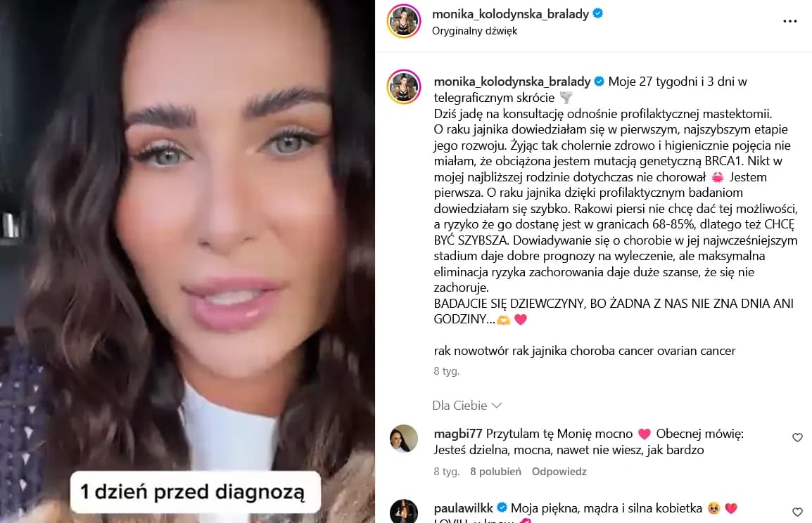 Wczesne objawy raka jajnika, które mogą uratować życie kobietom