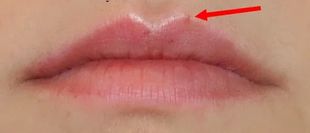 Jak zażywać heviran przed makijażem permanentnym ust, aby uniknąć problemów