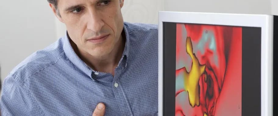 Miażdżyca przyczyna: Jak unikać najważniejszych czynników ryzyka