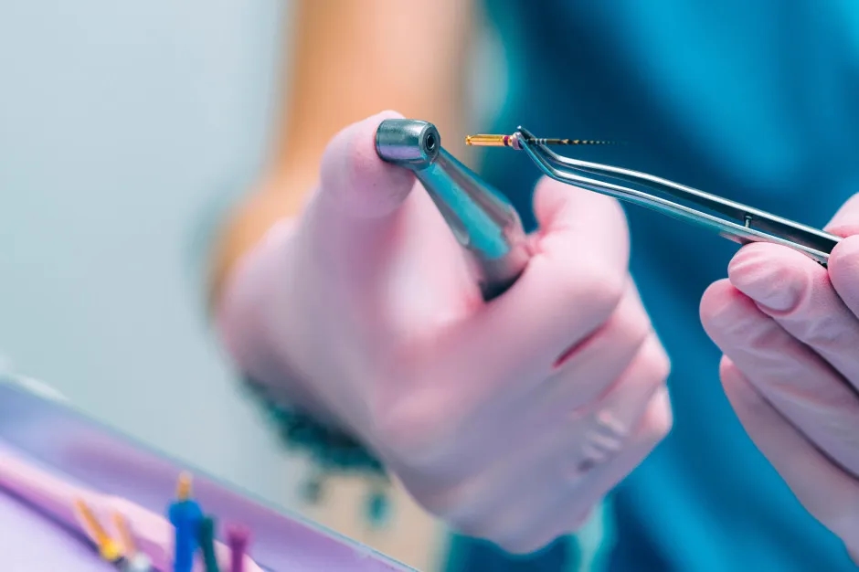 Ile kosztuje leczenie kanałowe na nfz? Sprawdź ceny i warunki