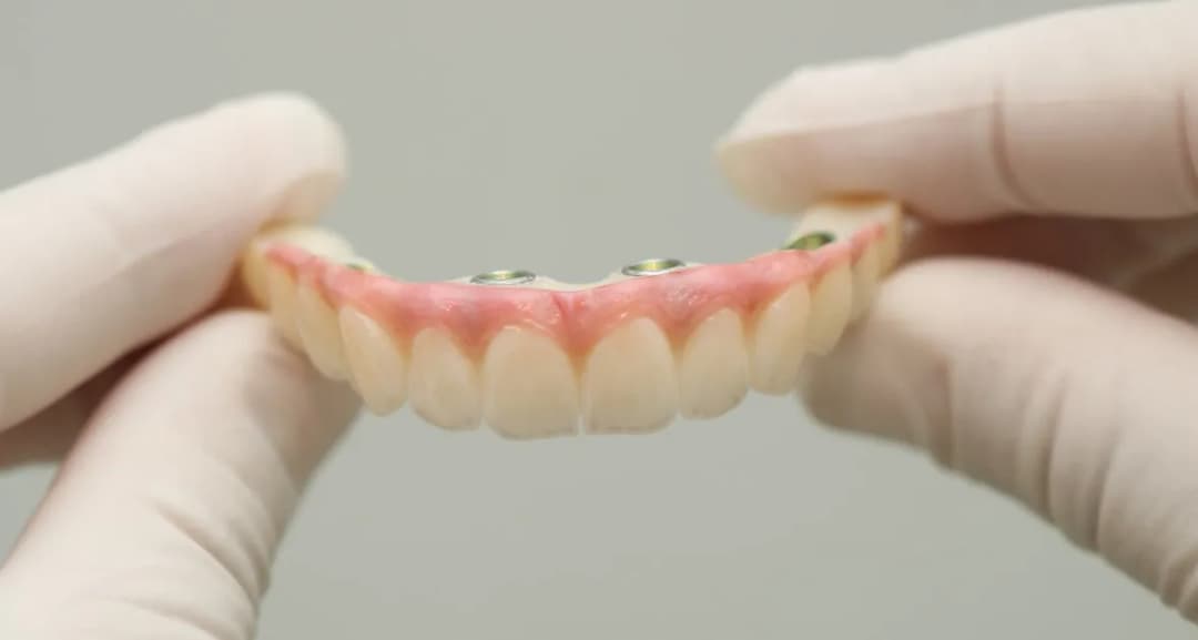 Ile kosztuje proteza zębowa na NFZ? Sprawdź, czy jest darmowa