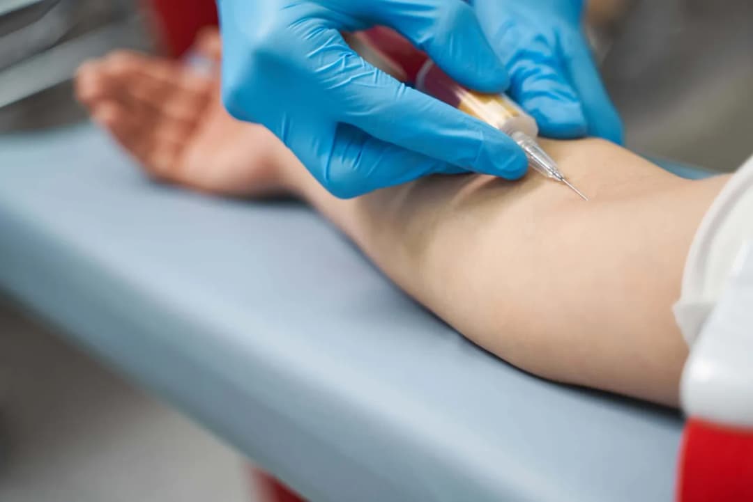 Jakie badania na keto warto wykonać przed rozpoczęciem diety?